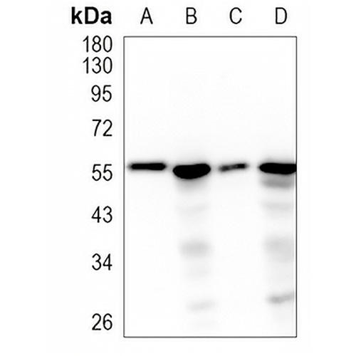 FMO3 Rabbit Monoclonal Antibody(C1210)