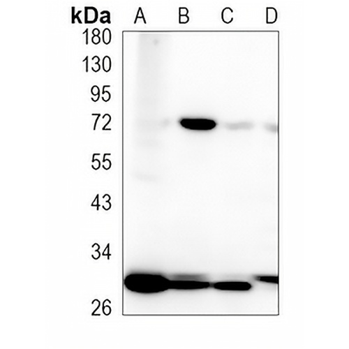MXD3 Rabbit Monoclonal Antibody(C1211)