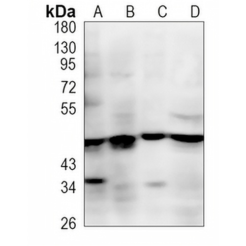 ENTPD5 Rabbit Monoclonal Antibody(C1212)