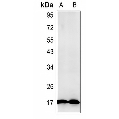 Myoglobin Rabbit Monoclonal Antibody(C1214)