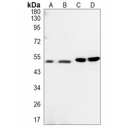 GFAP Rabbit Monoclonal Antibody(C1218)