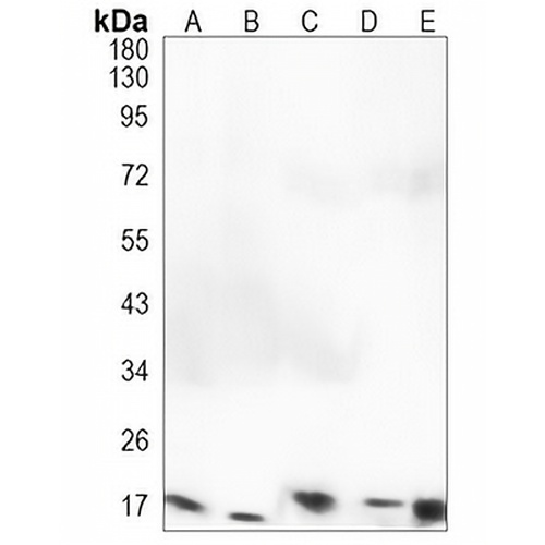 FGF1 Rabbit Monoclonal Antibody(C1219)
