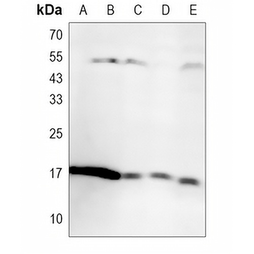 IBA1 Rabbit Monoclonal Antibody(C1220)