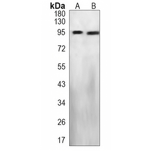 Axin-2 Rabbit Monoclonal Antibody(C1221)