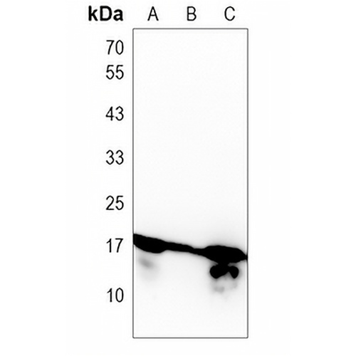 Histone H2B Rabbit Monoclonal Antibody(C1222)