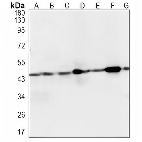 SEC14L2 Rabbit Monoclonal Antibody(C1224)