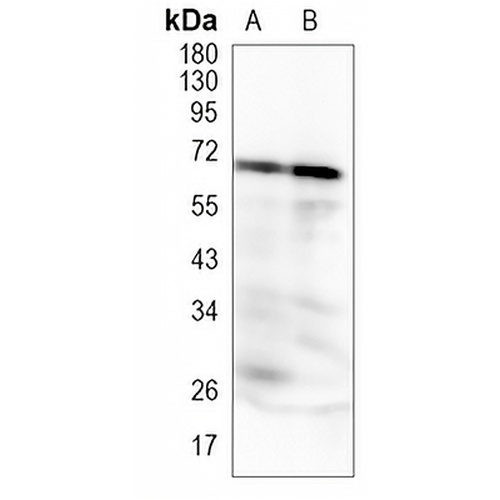 YY1 Rabbit Monoclonal Antibody(C1225)