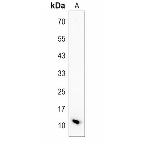 Hemoglobin gamma Rabbit Monoclonal Antibody(C1229)