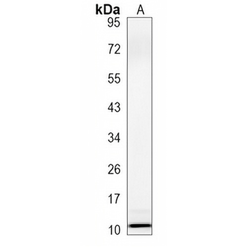 UQCRH Rabbit Monoclonal Antibody(C1230)