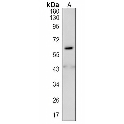 tPA Rabbit Monoclonal Antibody(C1231)