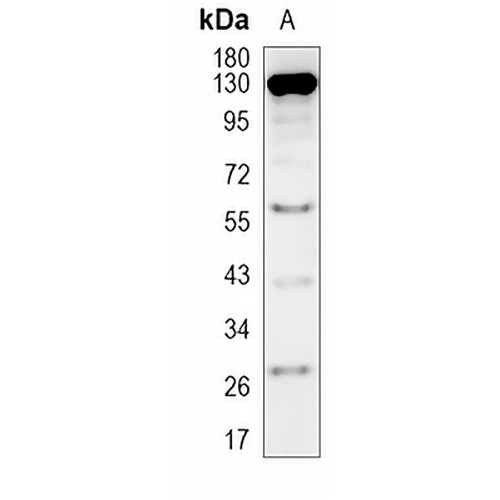 SRD5A2 Rabbit Monoclonal Antibody(C1232)
