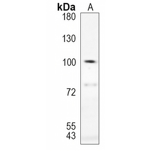 SATB1 Rabbit Monoclonal Antibody(C1233)