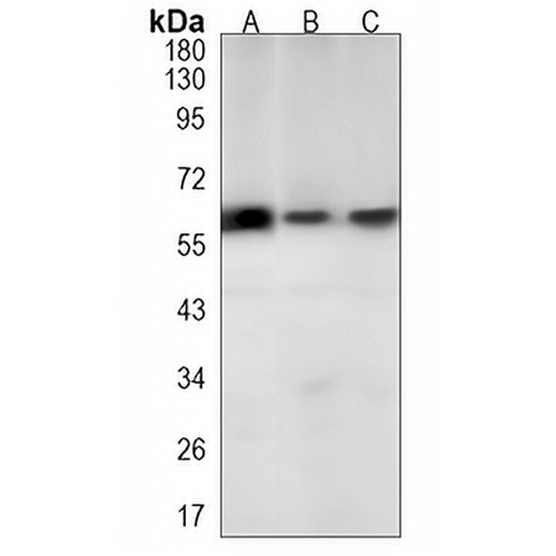 EAAT1 Rabbit Monoclonal Antibody(C1238)