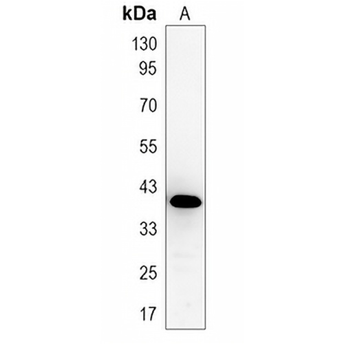 NKX2-1 Rabbit Monoclonal Antibody(C1239)