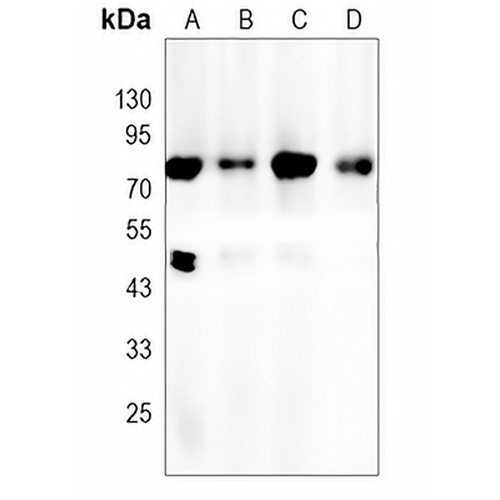 PKC beta Rabbit Monoclonal Antibody(C1240)