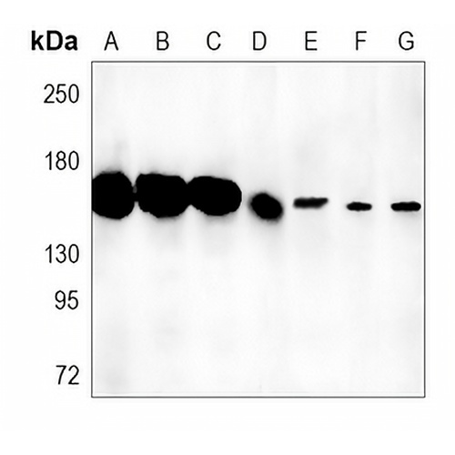 Collagen 3 alpha 1 Rabbit Monoclonal Antibody(C1242)
