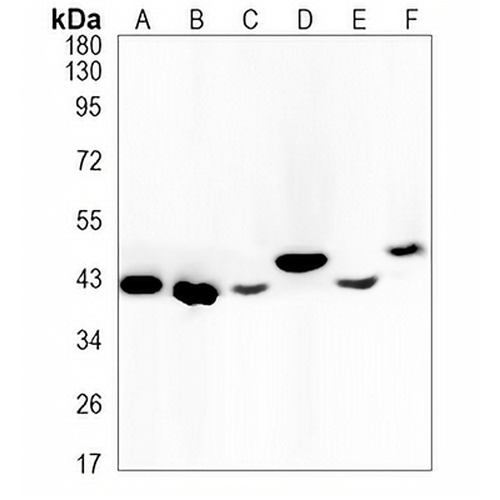CD79b  Rabbit Monoclonal Antibody(C1243)