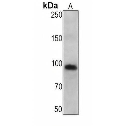 Complement C1S Rabbit Monoclonal Antibody(C1244)