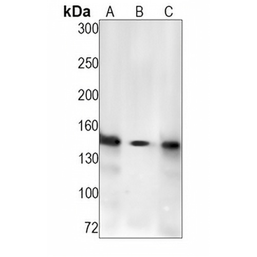 NCAPD2 Rabbit Monoclonal Antibody(C1245)