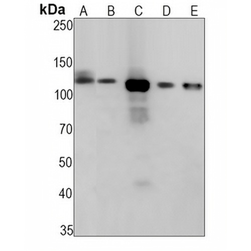 R Cadherin Rabbit Monoclonal Antibody(C1246)