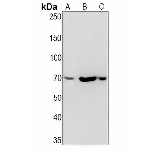 BLNK Rabbit Monoclonal Antibody(C1247)