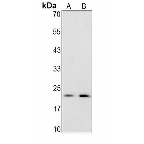 CDC8 Rabbit Monoclonal Antibody(C1248)