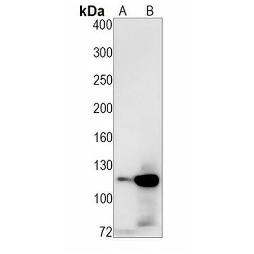 E Cadherin Rabbit Monoclonal Antibody(C1249)