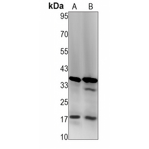 Caspase 3 Rabbit Monoclonal Antibody(C1251)