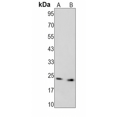 PARP1 (Cleaved-D214) Rabbit Monoclonal Antibody(C1252)