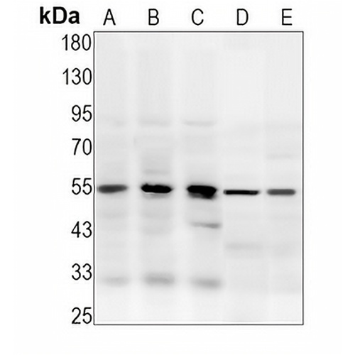 Caspase 8 Rabbit Monoclonal Antibody(C1253)