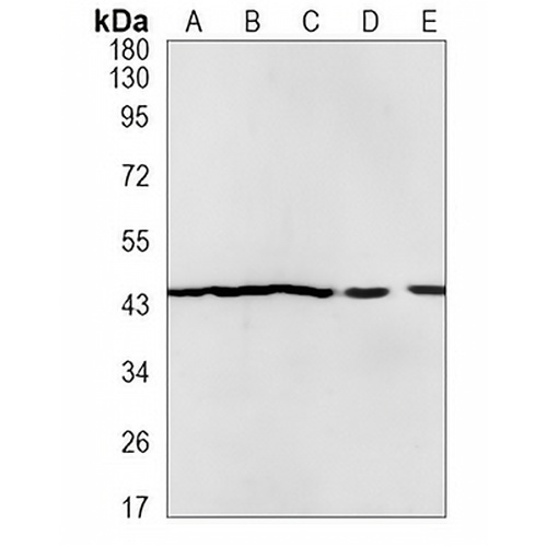 EGLN2 Rabbit Monoclonal Antibody(C1256)