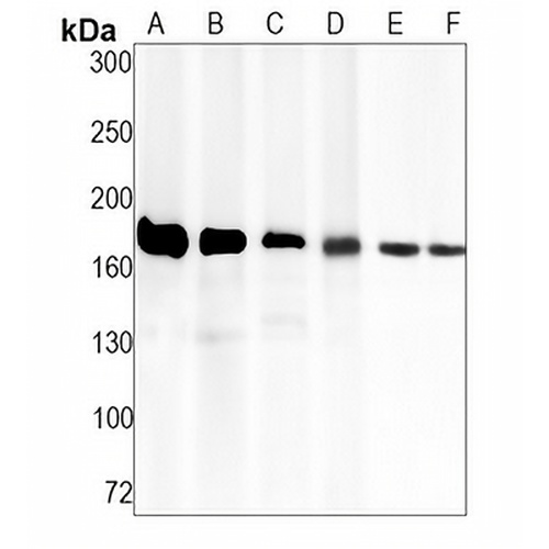VEGFR1 Rabbit Monoclonal Antibody(C1260)