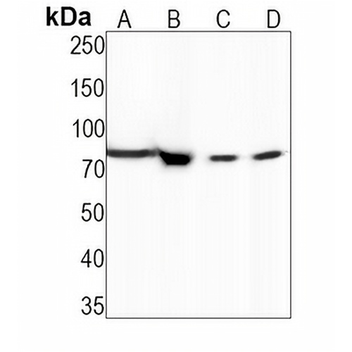 STAT1 Rabbit Monoclonal Antibody(C1264)