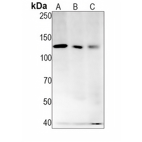 NOTCH1 Rabbit Monoclonal Antibody(C1267)
