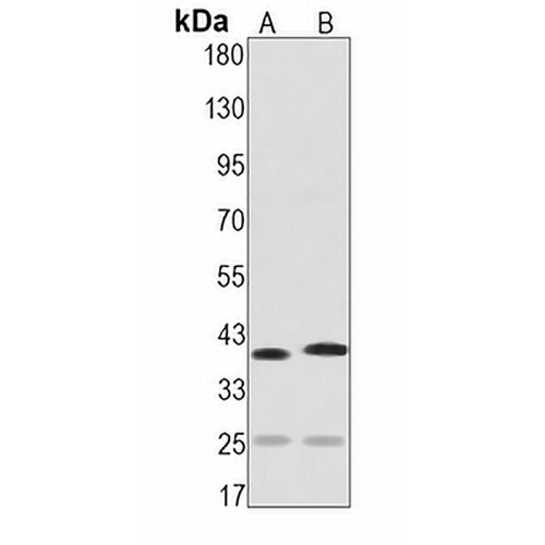 Synaptophysin Rabbit Monoclonal Antibody(C1268)