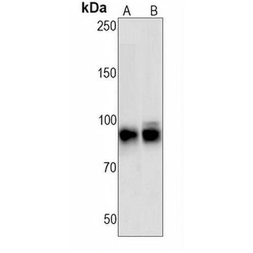 PARP1 (Cleaved-D214) Rabbit Monoclonal Antibody(C1270)