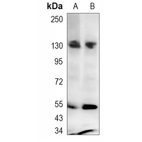 JAK2 Rabbit Monoclonal Antibody(C1271)