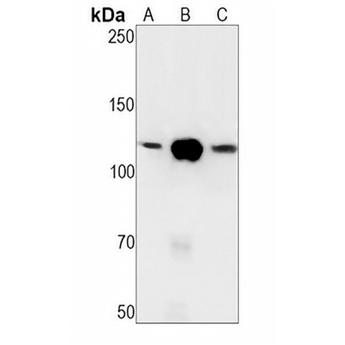 PARP1 Rabbit Monoclonal Antibody(C1272)