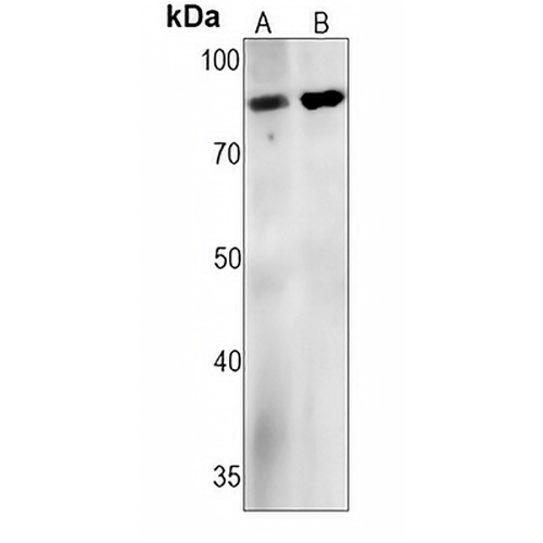 PI3K p85 alpha Rabbit Monoclonal Antibody(C1273)