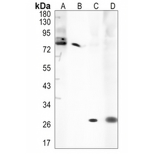 CD263 Rabbit Monoclonal Antibody(C1275)