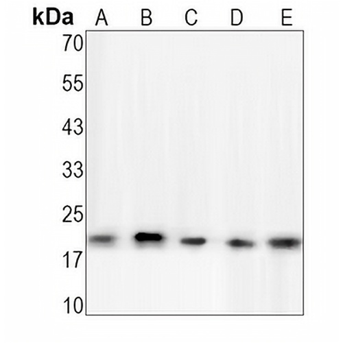 NRAS/HRAS/KRAS Rabbit Monoclonal Antibody(C1278)