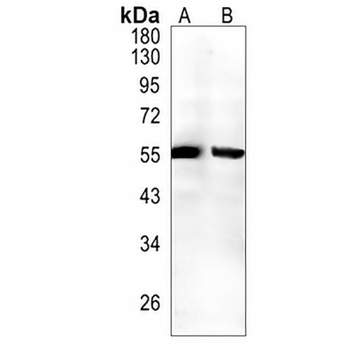 Caspase 8 Rabbit Monoclonal Antibody(C1280)