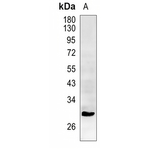 Aquaporin 5 Rabbit Monoclonal Antibody(C1281)