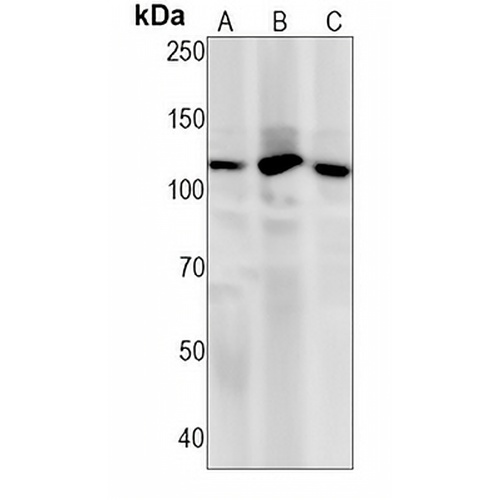 PI3K p110 beta Rabbit Monoclonal Antibody(C1282)
