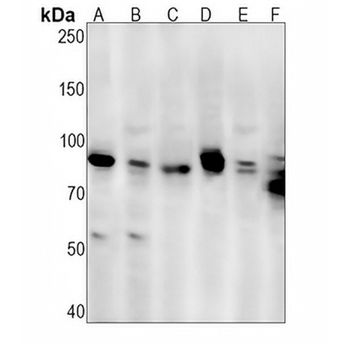 IKK alpha/beta Rabbit Monoclonal Antibody(C1283)