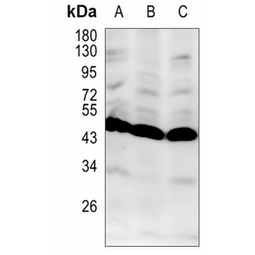 IKB beta Rabbit Monoclonal Antibody(C1284)