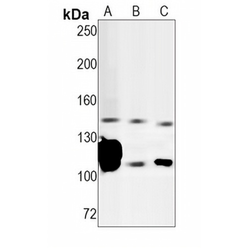 CD21  Rabbit Monoclonal Antibody(C1285)