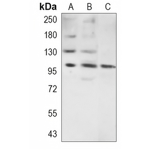 INPP4B Rabbit Monoclonal Antibody(C1288)