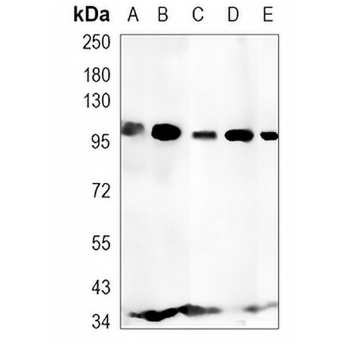 CD10  Rabbit Monoclonal Antibody(C1290)