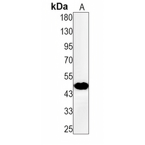 Cyclin E1 Rabbit Monoclonal Antibody(C1291)
